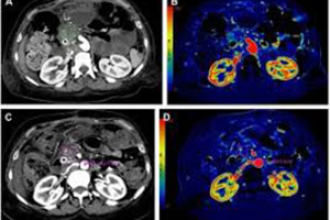 Multislice BT Multislice BT